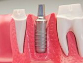 Clinica Dental Dr Malamud