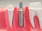 Clinica Dental Dr Malamud