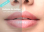 Consultorio de Dermatología