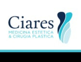 Ciares