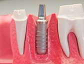 Odontologia Ugartemendia