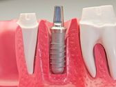 Odontologia Ugartemendia