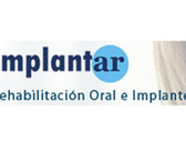 Implantar