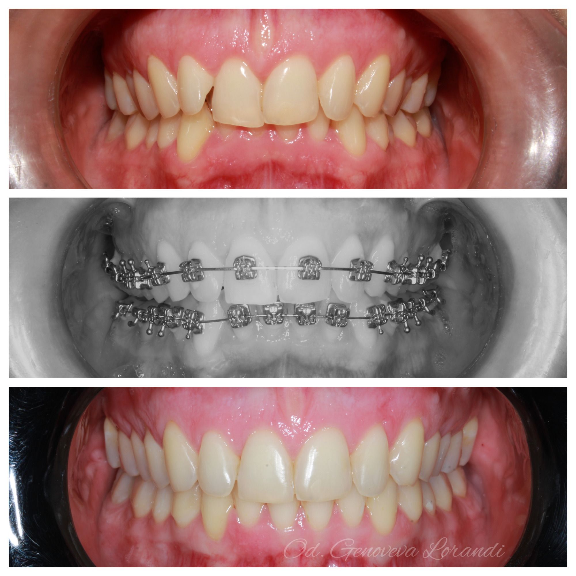 Antes y después Esteticas ar Esteticas ar