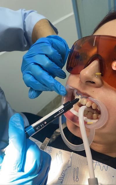 Procedimiento de Blanqueamiento dental