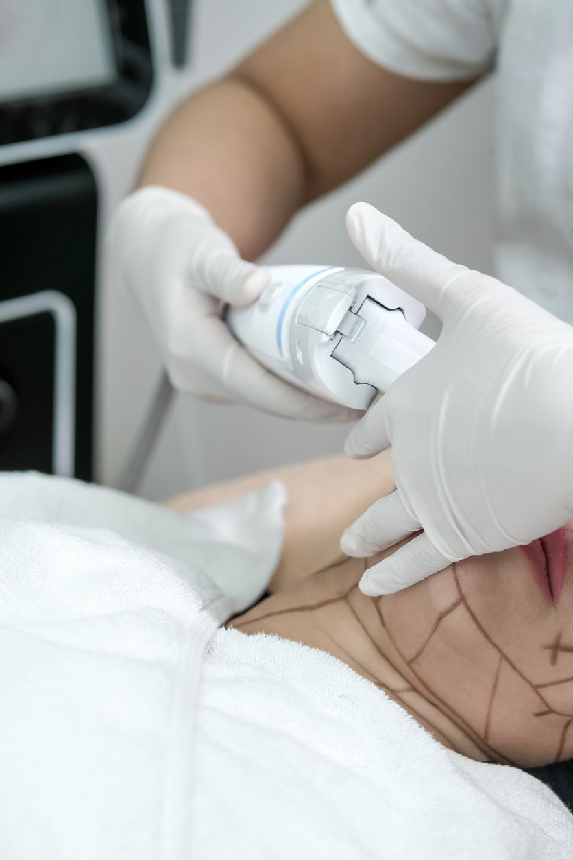 El HIFU utiliza ultrasonidos focalizados de alta intensidad para eliminar grasa localizada, corregir arrugas, reafirmar la piel.