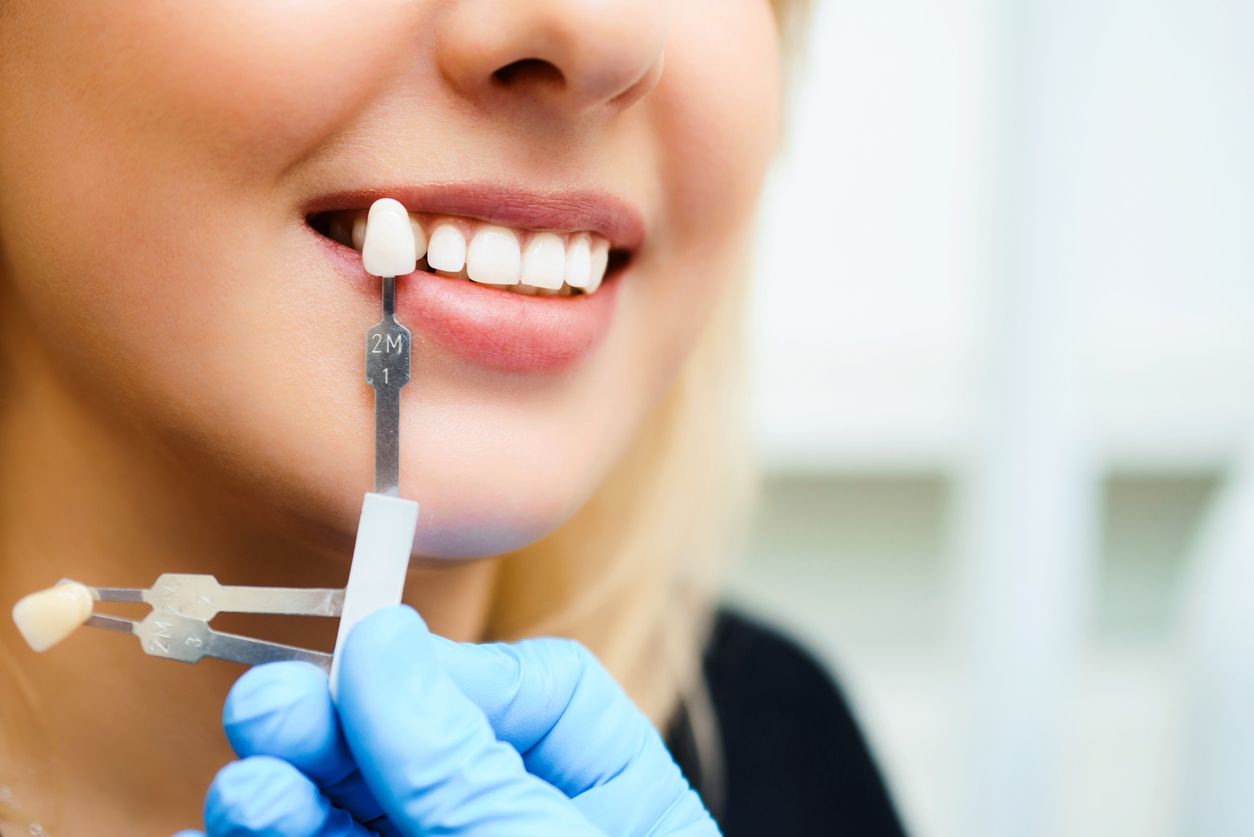 Prótesis dentales que mantienen el color y la forma de los dientes originales.