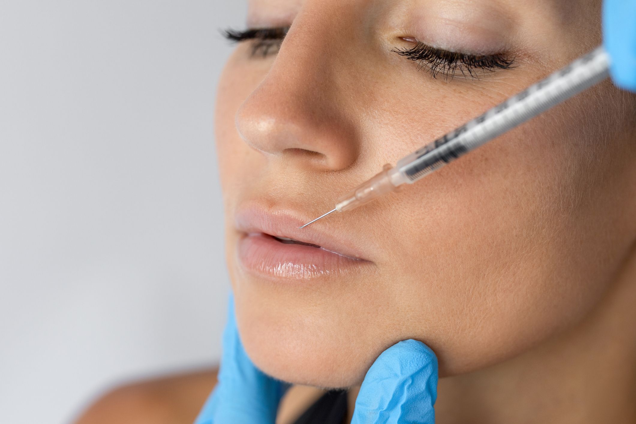 La hialuronidasa es una enzima que está ganando mucho terreno en el campo de la medicina estética en casos de emergencia