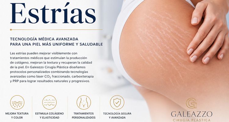 Estrias