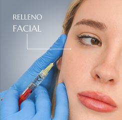 Relleno Facial - Dr. Nadir Carda