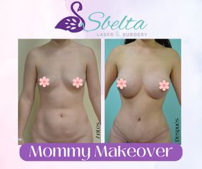 Mommy Makeover - Dra. Jessica Ramírez Cadena