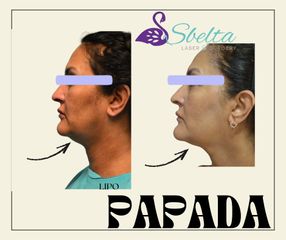 PAPADA - Dra. Jessica Ramírez Cadena