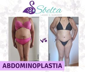 ABDOMINO Y LIPO