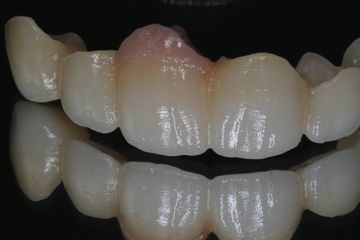 Dentalis Aesthetic