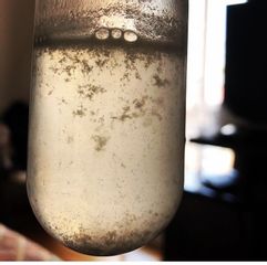 Hidromicrodermoabrasión