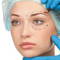 El pre y el post operatorio de la blefaroplastia