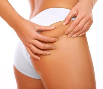 6 alimentos que provocan celulitis