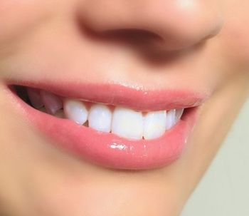 Dientes blancos: ¿mito o verdad?