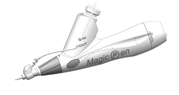 Magic Pen, una nueva técnica para borrar tatuajes