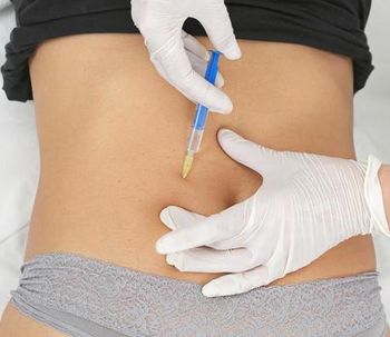 La carboxiterapia en el tratamiento de la celulitis y la flacidez