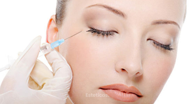 Mitos y verdades sobre el Botox