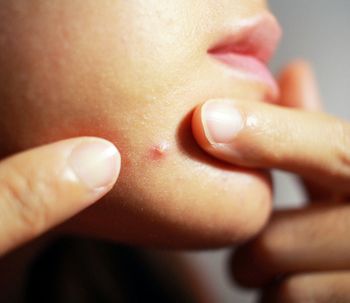 ¿Qué dicen los granos de nuestra salud?