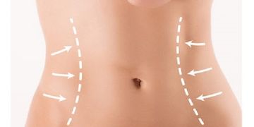 Qué tener en cuenta antes de una cirugía de abdomen Qué tener en cuenta antes de una cirugía de abdomen