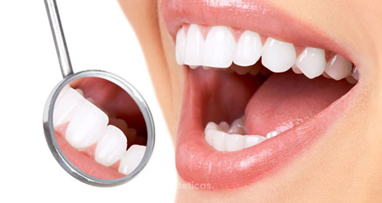 Carillas dentales: ¿qué hay detrás de la sonrisa perfecta?