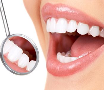 Carillas dentales: ¿qué hay detrás de la sonrisa perfecta?