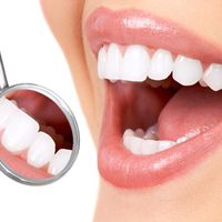 Carillas dentales: ¿qué hay detrás de la sonrisa perfecta?