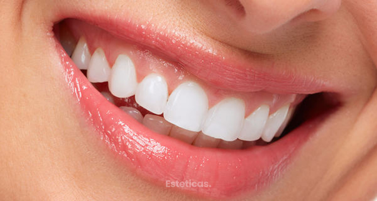 La odontologia adhesiva