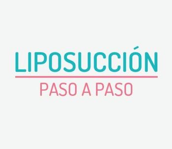 La liposucción: todo lo que tenés que saber