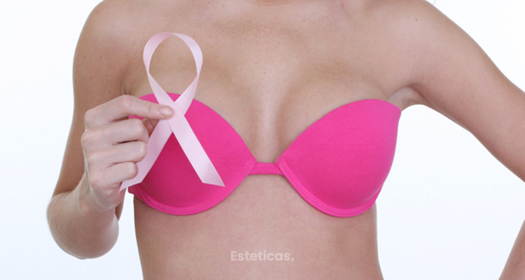 La importancia del diagnóstico y la detección precoz en el cáncer de mama