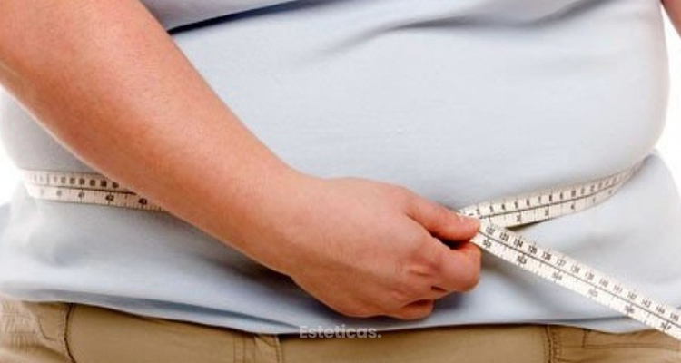Qué es la obesidad y cuántos tipos hay