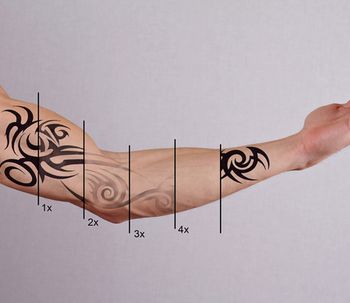 Eliminar tatuajes: lo que hay que saber