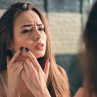 Cuidar la piel en el tratamiento del acné