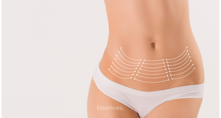 Lipoaspiración de alta definición