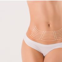 Lipoaspiración de alta definición