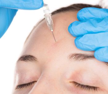 Todo lo que tenés que saber sobre rellenos faciales