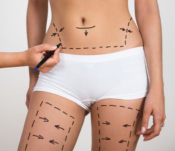 Tener un abdomen perfecto con la lipoabdominoplastia