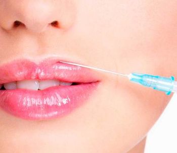 Aumento de labios: un tratamiento cada vez más solicitado