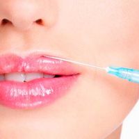 Aumento de labios: un tratamiento cada vez más solicitado