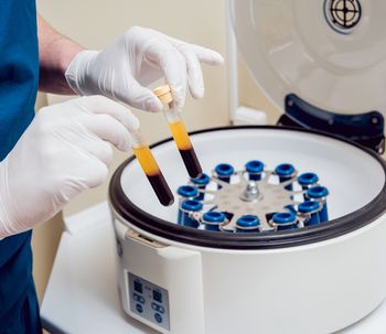 Beneficios y contraindicaciones del Plasma Rico en Plaquetas