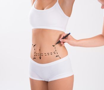 Eliminá la grasa localizada con TruSculpt 3D