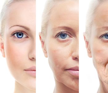 Todo sobre el resurfacing, rejuvenecimiento facial con láser CO2 fraccionado
