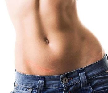 Abdominoplastia y mini-dermolipectomìa