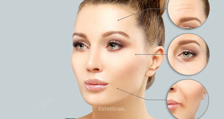 Correcta aplicación del Botox