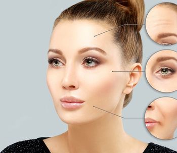 Correcta aplicación del Botox