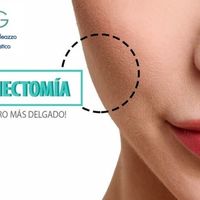 Bichectomia y adelgazamiento facial