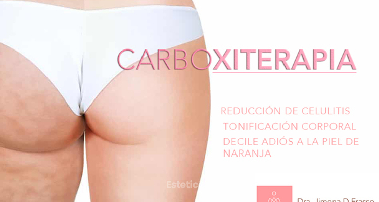 El mejor tratamiento para la celulitis